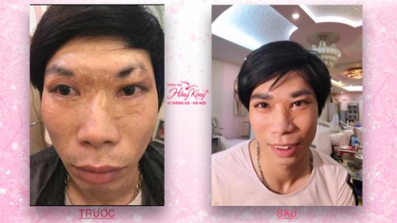 Phượng Hồng Kông, Thẩm mỹ Hồng Kông 51 Hàng Gà, Phun xăm thẩm mỹ