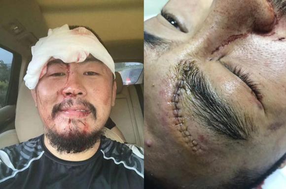 Từ Hiểu Đông , võ thuật Trung Quốc , võ sĩ MMA, Ngô Kinh