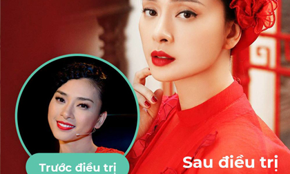 BB Thanh Mai, Trẻ hóa da, MC Thanh Mai