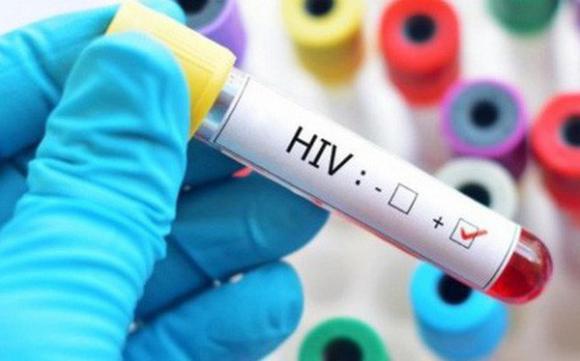 HIV, chữa khỏi HIV, Căn bệnh thế kỷ