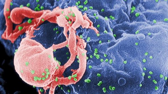 HIV, chữa khỏi HIV, Căn bệnh thế kỷ