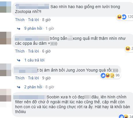 Soobin Hoàng Sơn, ảnh mới Soobin Hoàng Sơn, Soobin Hoàng Sơn phẫu thuật