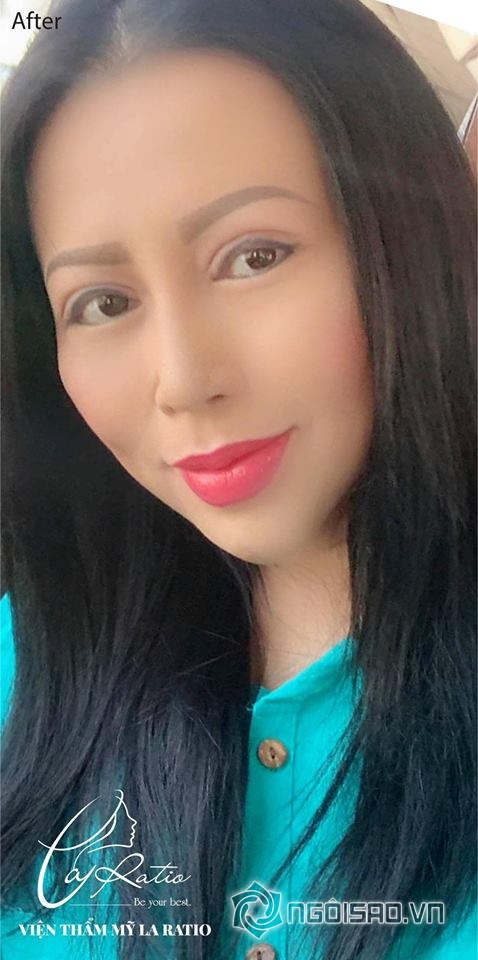 kristine-thao-lam-193-1-ngoisao.vn-w478-h960 8 Kristine Thảo Lâm, Viện thẩm mỹ la ratio