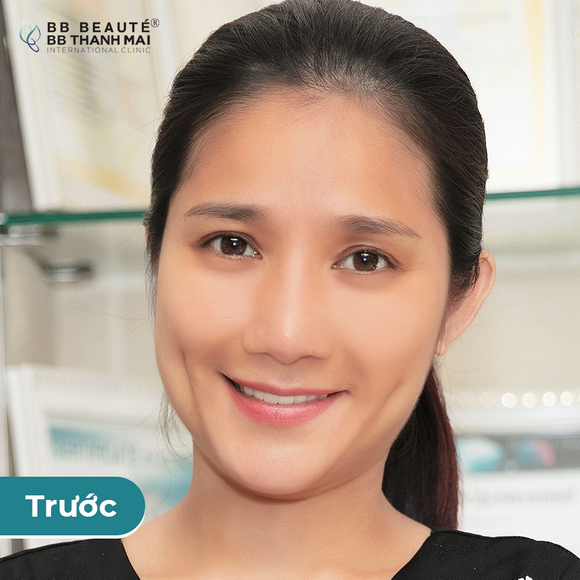 bb-thanh-mai-273-1-ngoisao.vn-w580-h580 7 BB Thanh Mai, Trẻ hóa da, MC Thanh Mai