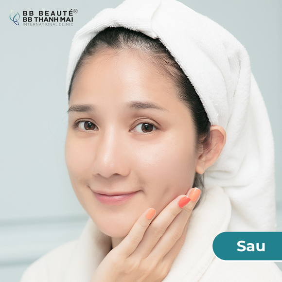 bb-thanh-mai-273-2-ngoisao.vn-w580-h580 6 BB Thanh Mai, Trẻ hóa da, MC Thanh Mai