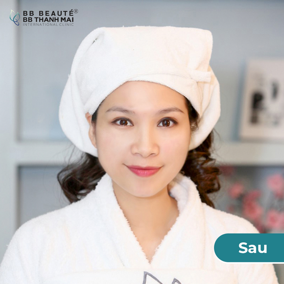 bb-thanh-mai-273-3-ngoisao.vn-w580-h580 5 BB Thanh Mai, Trẻ hóa da, MC Thanh Mai