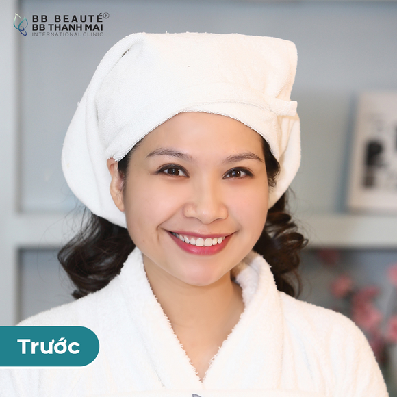 bb-thanh-mai-273-4-ngoisao.vn-w580-h580 4 BB Thanh Mai, Trẻ hóa da, MC Thanh Mai