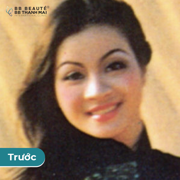 bb-thanh-mai-273-5-ngoisao.vn-w580-h580 3 BB Thanh Mai, Trẻ hóa da, MC Thanh Mai
