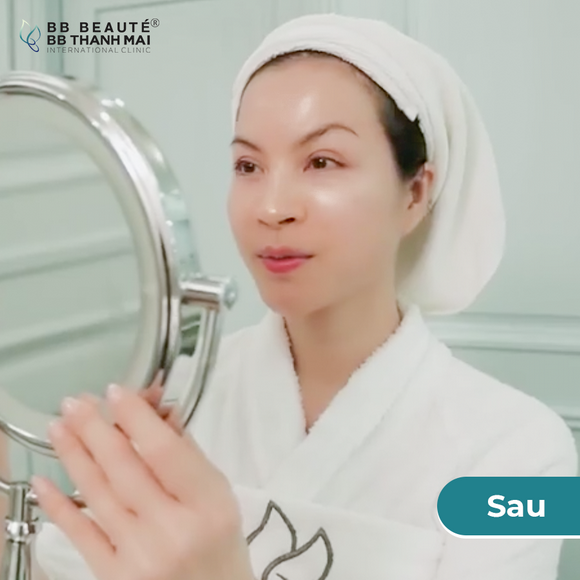 bb-thanh-mai-273-6-ngoisao.vn-w580-h580 2 BB Thanh Mai, Trẻ hóa da, MC Thanh Mai