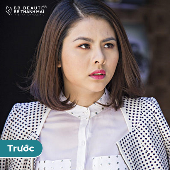 BB Thanh Mai, Trẻ hóa da, MC Thanh Mai