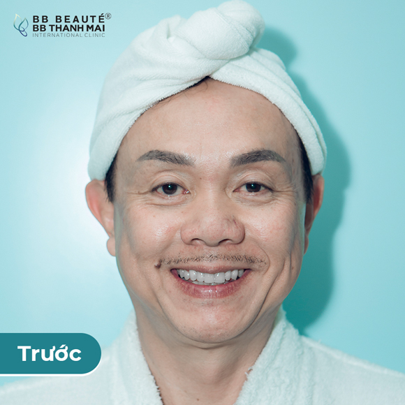bb-thanh-mai-104-3-ngoisao.vn-w580-h580 2 BB Thanh Mai, Chí Tài, Trẻ hóa da