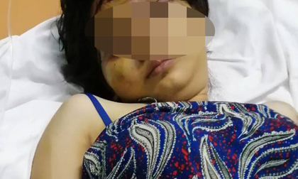 Thai phụ bị tra tấn, tra tấn cô gái đến sảy thai, tin pháp luật