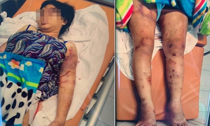 Thai phụ bị tra tấn, tra tấn cô gái đến sảy thai, tin pháp luật