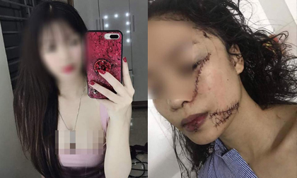 Rạch mặt thiếu nữ ở Bắc Ninh, Thiếu nữ 18 bị rạch mặt, Tin pháp luật