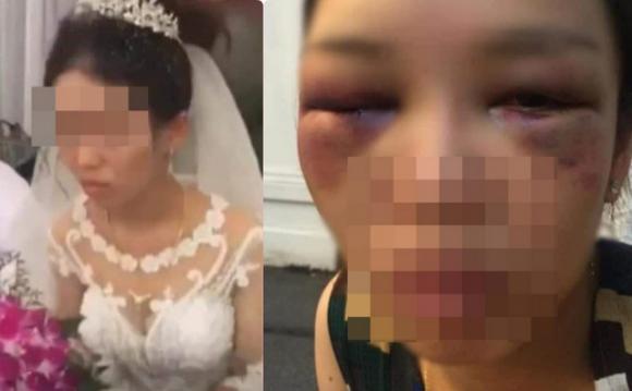 cô dâu bị đánh thâm tím mặt mày, mạng xã hội, Hành động lạ của cô dâu trong đám cưới