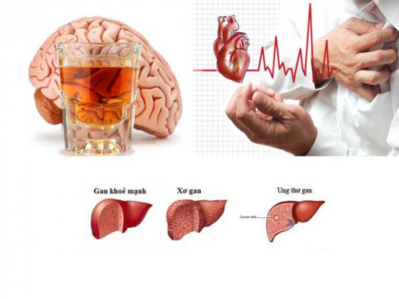 Uống rượu bia thường xuyên, Tác hại của bia rượu, Thói quen gây bệnh