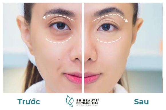 bb-thanh-van-235-4-ngoisao.vn-w580-h387 5 Ngô Thanh Vân, Sĩ Thanh, Miko Lan Trinh, BB Thanh Vân