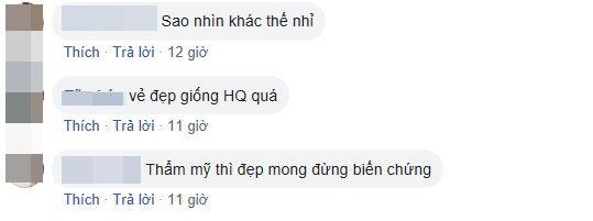 Min, Min khác lạ, Min giống Hari Won, Min phẫu thuật thẩm mỹ