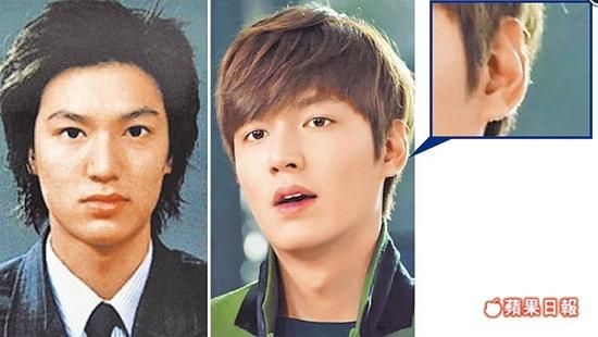 lee min ho, phẫu thuật thẩm mỹ, sao hàn