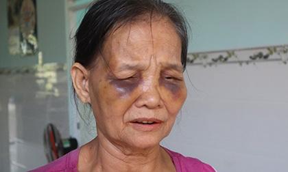 cô dâu Việt bị chồng Hàn đánh, bạo lực gia đình, tin pháp luật