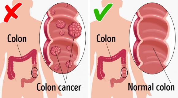 tác dụng của dưa chuột, nên ăn dưa chuột 1 quả mỗi ngày, chăm sóc sức khỏe