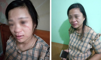 Thai phụ bị chồng đánh, bạo lực gia đình, tin nóng
