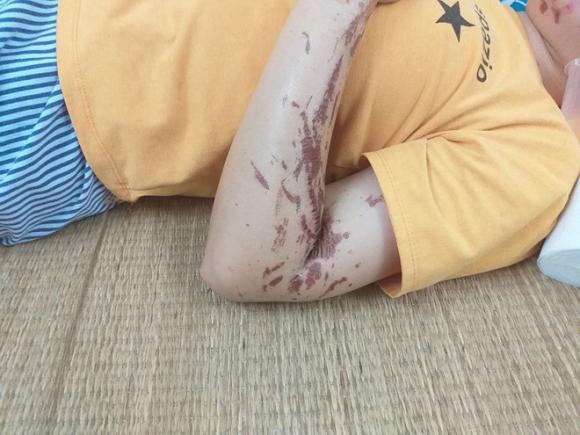 Tạt axit, Tin pháp luật, Vào bếp tạt axit vào mặt người phụ nữ