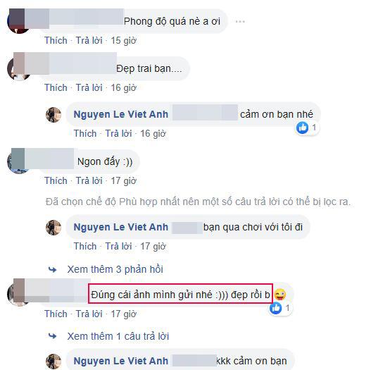 Việt Anh,  phẫu thuật thẩm mỹ, sao viet