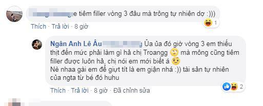 Lê Âu Ngân Anh ,  tiêm filler, sao Việt