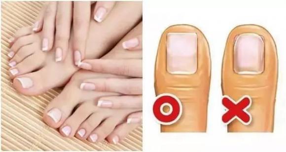 cắt móng tay đến đâu là hợp lý, lưu ý khi cắt móng tay, cắt móng tay đúng cách