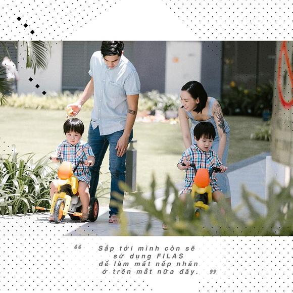 Quỳnh Trâm, Xóa rạn da bằng công nghệ Filas, Xóa rạn da không cần phẫu thuật thẩm mỹ