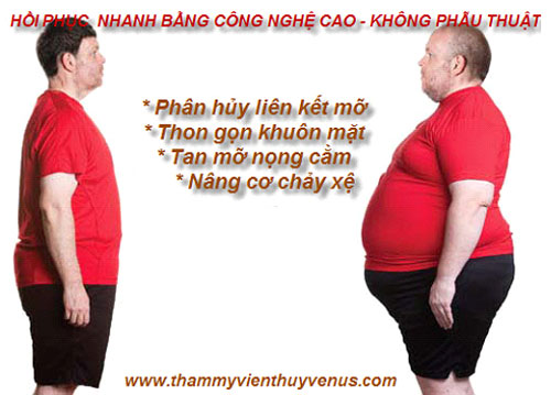 Thủy Venus,Thủy Venus khuyến mãi,dịp 8/3,phẫu thuật giảm mỡ