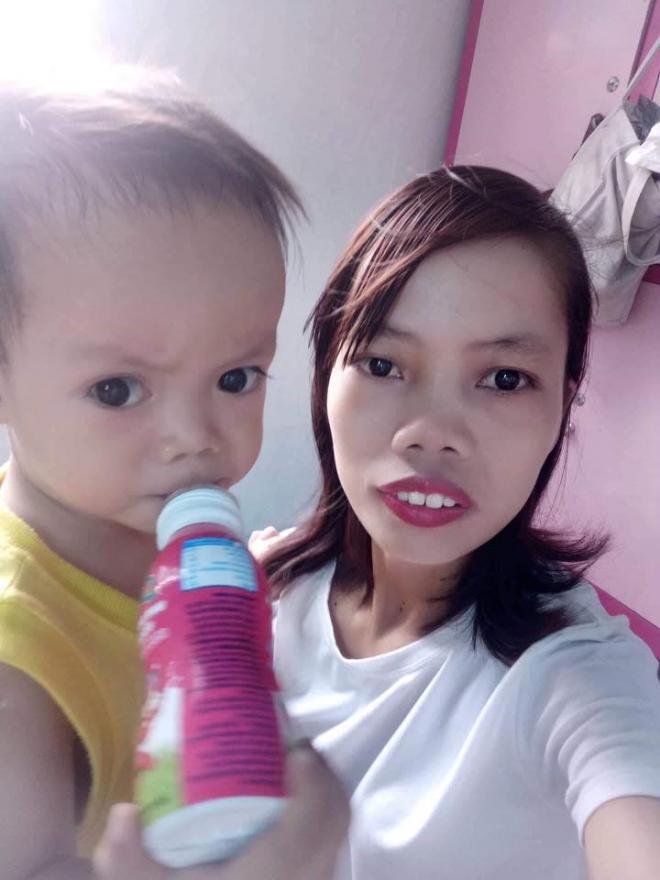 phẫu thuật thẩm mỹ, dao kéo, mẹ đơn thân